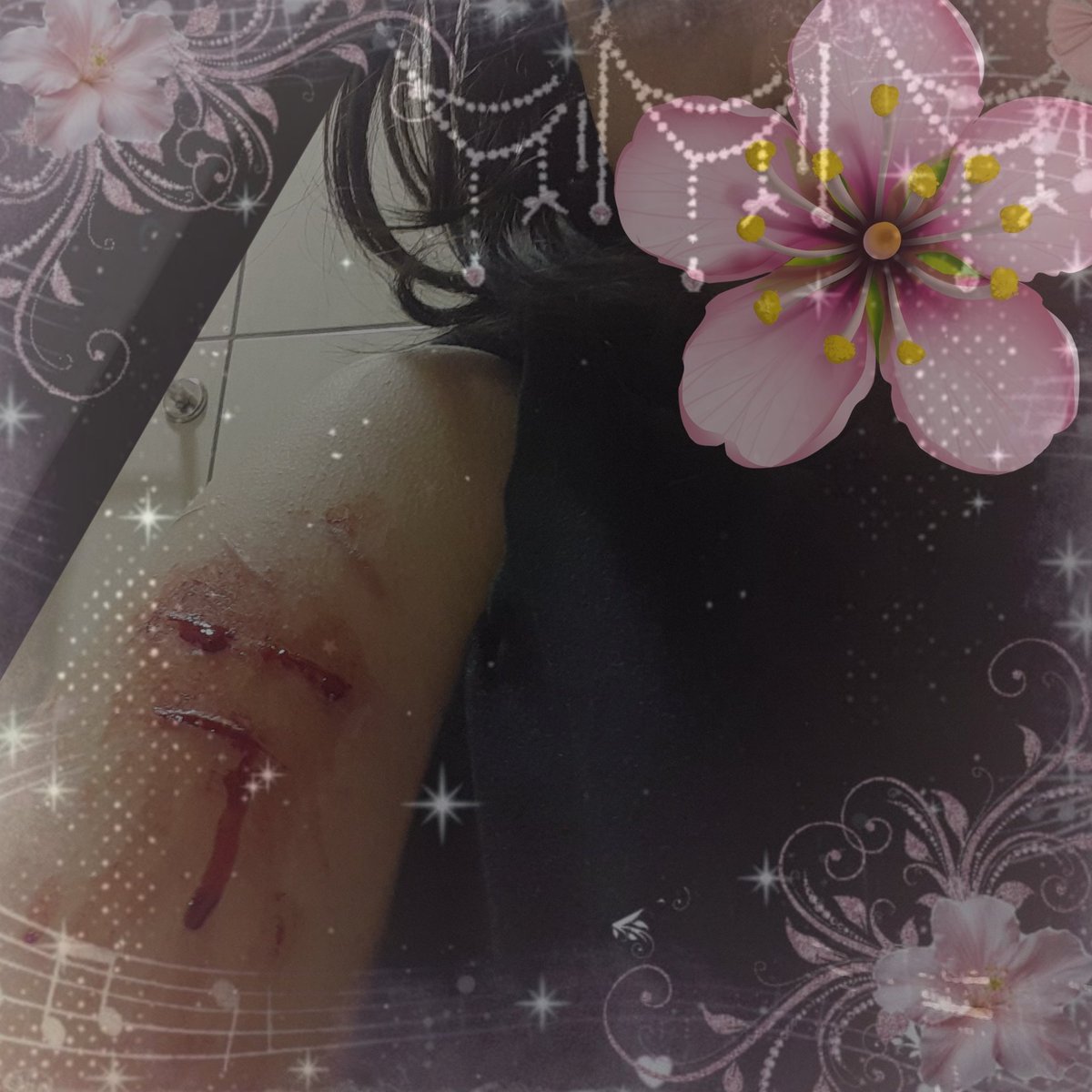 xddmina's tweet photo. this is an old one but still good (I guess)

all fake! AI! fake blood! SFX make up made by professional! Halloween costume!
#shedtwt #shtwt #sfxtwt #shrtwt #slittwt #ouchietwt #988twt #styrotwt https://t.co/8dbP5E90O9