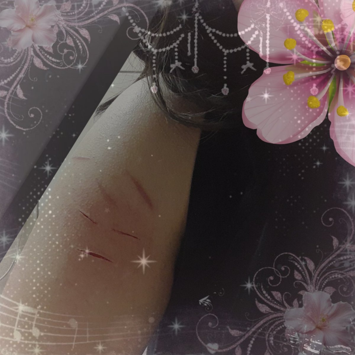 xddmina's tweet photo. this is an old one but still good (I guess)

all fake! AI! fake blood! SFX make up made by professional! Halloween costume!
#shedtwt #shtwt #sfxtwt #shrtwt #slittwt #ouchietwt #988twt #styrotwt https://t.co/8dbP5E90O9