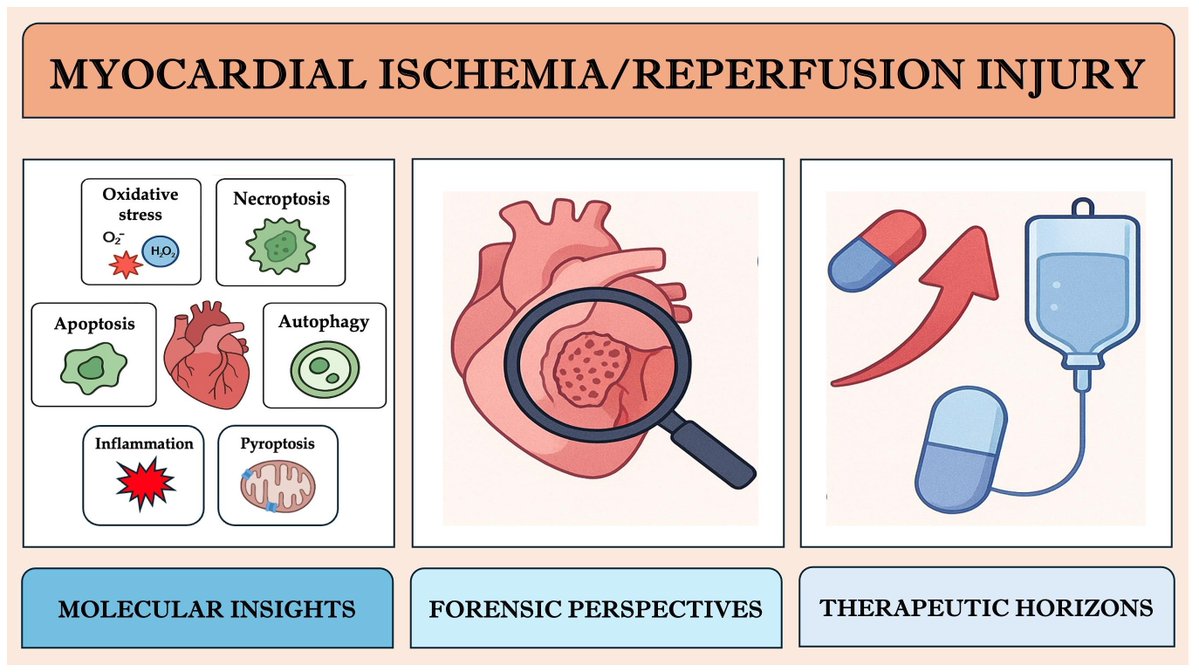 LifesciMdpi's tweet photo. β€οΈβπ©Ή What happens after blood flow returns to the heart?
This review highlights the molecular mechanisms behind reperfusion injury and emerging cardioprotective strategies.
π https://t.co/t3Zv9a4BGY
#CellsJournal #HeartHealth #CardiovascularResearch #MedicalResearch https://t.co/cdTwe3YdBg