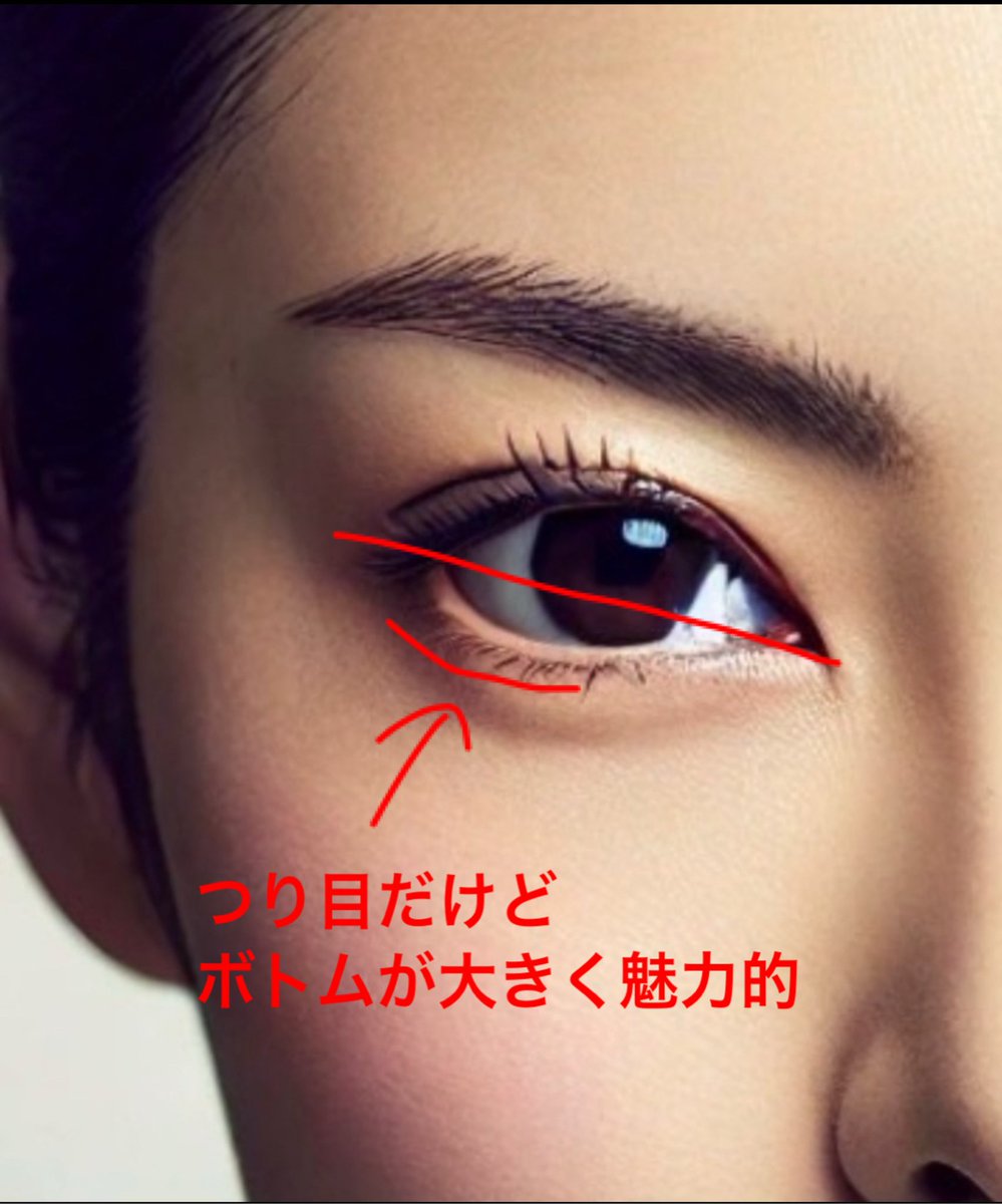beauty_sub7's tweet photo. タレ目形成で
整形顔になるのは
手技とデザインのせいですね https://t.co/imxDMoihs1