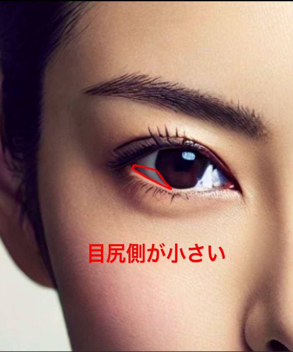 beauty_sub7's tweet photo. タレ目形成で
整形顔になるのは
手技とデザインのせいですね https://t.co/imxDMoihs1