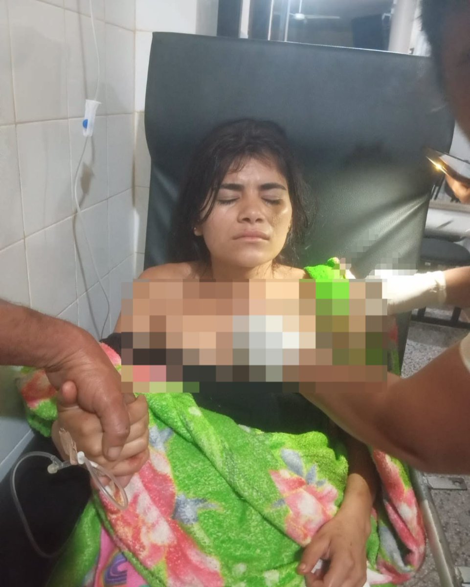 delpynews's tweet photo. ▶️IMÁGENES MUY SENSIBLES: FUE ATACADA A MACHETAZOS | ​🔴

🛑Una joven de 19 años fue víctima de un intento de feminicidio en Loreto, departamento de Concepción, alrededor de las 21:30 h de anoche.

👉Se trata de María Aparecida Medina Salinas, quien fue atendida en el Centro de Salud de Loreto.

📌El presunto autor sería su pareja, Celso Toledo González (22), que, supuestamente, se autolesionó tras perpetrar el ataque.

Vía: UH