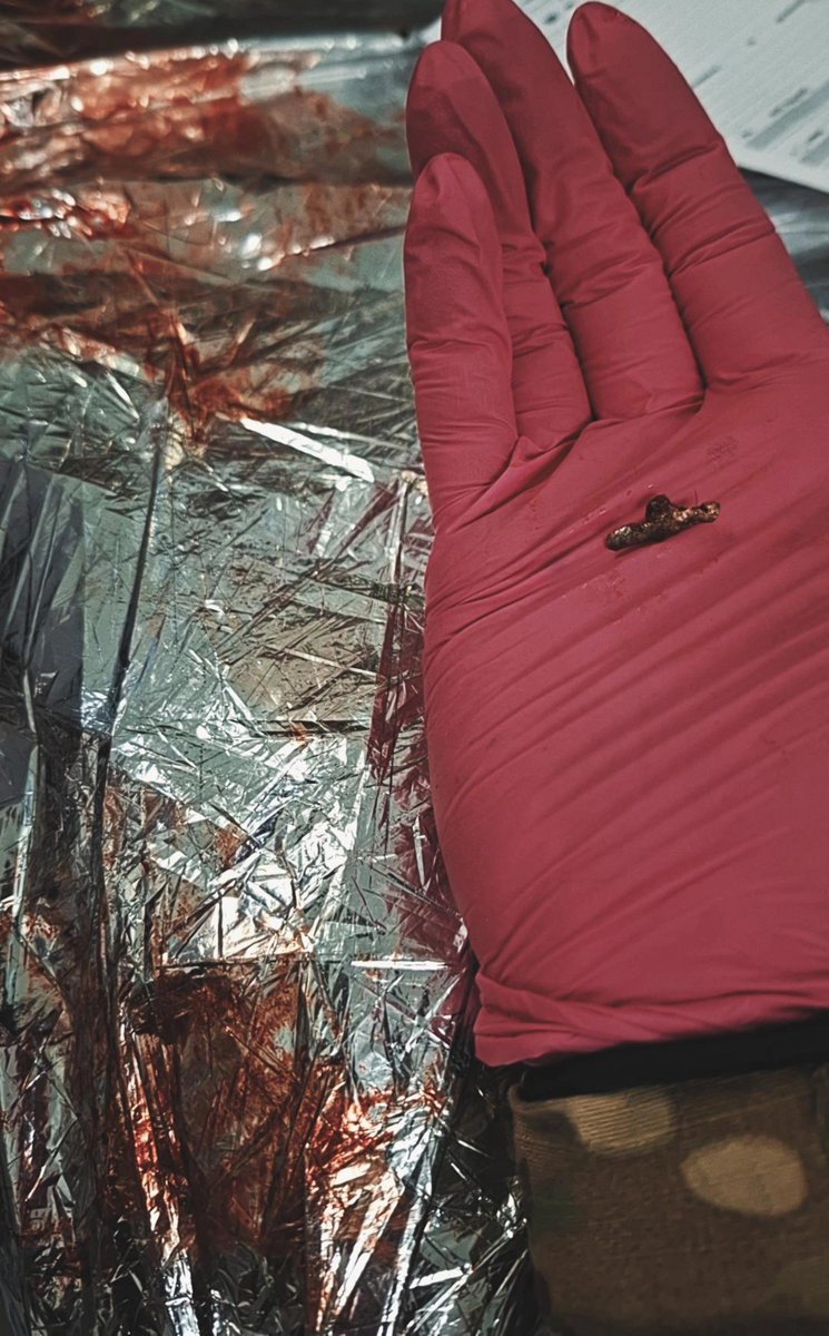 rima_medUA's tweet photo. "Am I alive?" 

A question my red casualty asked me as I was cutting his clothes to check for other injuries. He was a critical casualty going in and out of consciousness. I told him he was alive and that he is in our medevac. 

From that point it was a fight to the finish line. We were being covered by members of our squadron as FPVs flew in the area. My only focus was getting the IV line established to administer necessary medications immediately. We had no time to spare. Foley catheter was placed by my brother in arms, vitals monitor was on and going. His hands were covered in blood and so cold so I scrubbed one finger clean where there was no shrapnel (which was in several places) and tried to  warm up his finger so I could get a reading. He lost a lot of blood and that was clear from his low blood pressure reading so we knew we didn't have much time. It became too dangerous for us to continue so we evacuated. I started his meds while we sped away from our point to the next level of care. My goal was to keep him talking until we arrived and keep ahead of what possible problems could arise on the drive. 

We arrived at the hospital and from there, doctors got to work. 

My only thought was thank God we made it and that he is alive. 

I am grateful every day to be able to help save lives and lucky to serve with incredibly brave people by my side.