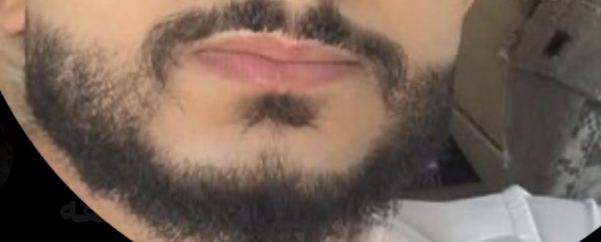 dr_3nzh's tweet photo. @alzbiadi2 شعيره ام الرعيان لها عين تتكلم 🤣🤣
شعيراتك هاذي ناتفها من طويز حوثيييي 🤣🤣 https://t.co/3sS9Ig6Drd