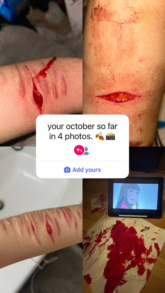 tastefulfailure's tweet photo. thought this was silly #shtwtt FAKE AI FAKE BLOOD. (NO. i did NOT post this. i am not a moron.) https://t.co/JZftzj2TJU