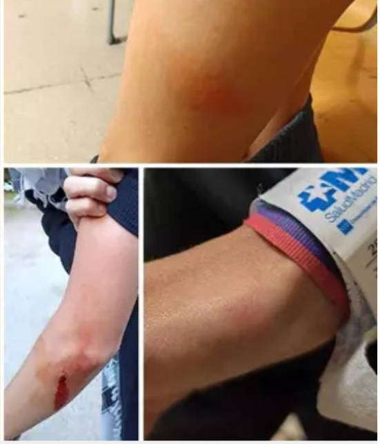 JulianMaciasT's tweet photo. La estudiante a la que la policía le ha roto el cúbito mientras se manifestaba por la educación pública denunciará al agente que le agredió, asegura que puso el brazo para protegerse porque el porrazo iba a la cara.
https://t.co/kYJlG1klmC https://t.co/ZE4rtrr7ky