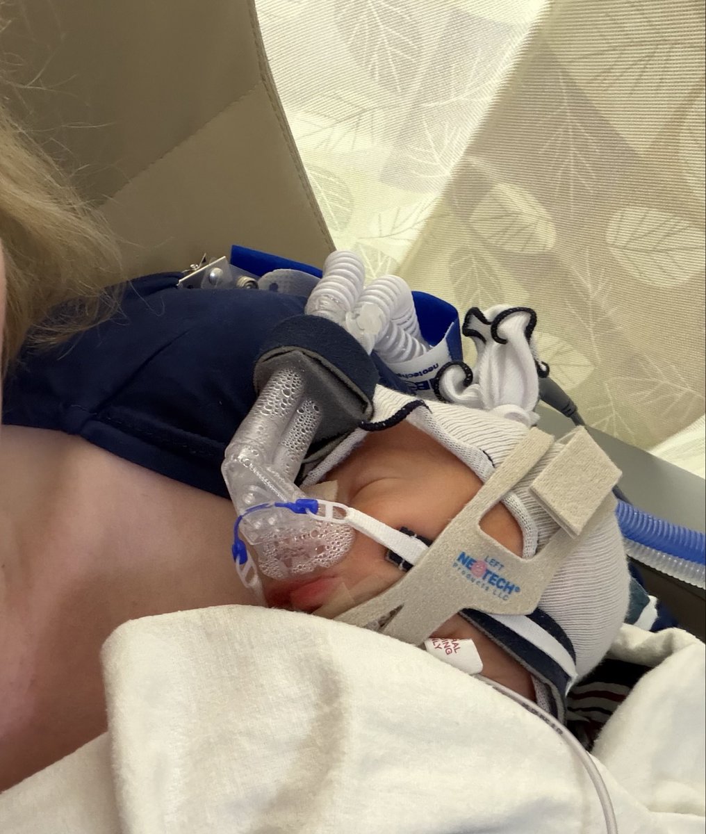 EithanDHaimMD's tweet photo. Our twin boys, Levi and Asher, were born just a few days ago. 

So far, Asher is ahead when it comes to time spent in the ten finer penalty box (i.e mittens for pulling off his CPAP). But the daily poop count shows Levi with a commanding lead.

Given their mutual ability to go Frank-The-Tank on tube feeds, it could be anyone’s game.