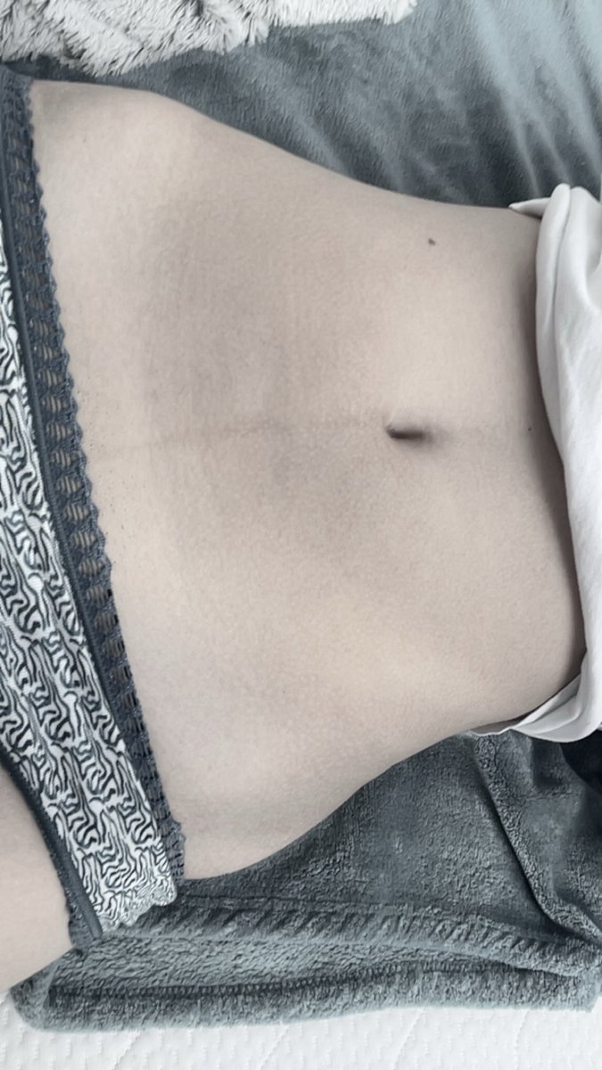 eppybunny000's tweet photo. i’m back and going back on my track to be skinny https://t.co/6osUCNIch0