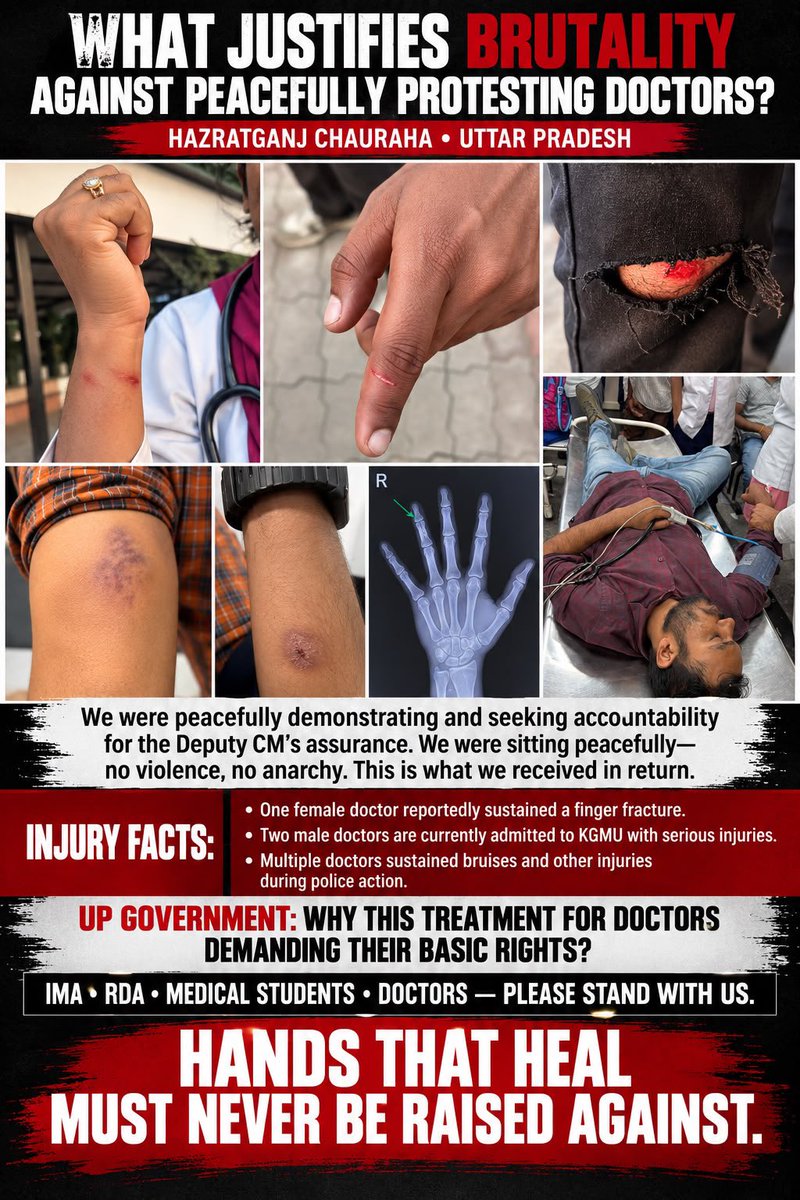 drjaswantvoice's tweet photo. 🚨 योगी सरकार जवाब दो! डॉक्टरों पर ये अत्याचार क्यों?
यूपी में प्रदर्शनकारी डॉक्टरों पर बर्बरता के गंभीर आरोप हैं। हमारे साथियों के हाथ-पैर में चोटें, उंगलियाँ टूटने की शिकायतें, कपड़े फाड़ना और घसीटकर हिरासत में लेना—क्या यही है योगी सरकार का न्याय?
कॉलेज बॉन्ड और CSM/PCS में कार्यरत डॉक्टरों के समान वेतन की मांग क्या गलत है? डिप्टी CM के आश्वासन के डेढ़ महीने बाद भी कार्रवाई क्यों नहीं? तीन दिन से प्रदर्शन कर रहे डॉक्टरों से बातचीत तक क्यों नहीं?
बीजेपी सरकार जवाब दे! डॉक्टरों को न्याय चाहिए, लाठियाँ नहीं!
#JusticeForDoctors #UPPolice #YogiGovernment #DoctorsProtest  @Uppolice @UPPViralCheck @ANI @PTI @myogiadityanath @mpbrijeshpathak @BJP4UP @UPGovernor @brajeshpathakup @PMOIndia @JPNadda @Nffmgs_official @DrDhruvchauhan @imajdnnational @IMAIndiaOrg @1stIndiaNews @aajtak @TheNewspinch @TheLallantop @NewsUp @dgpup @ANINewsUP @AmarUjalaNews