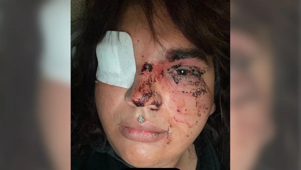 manelmarquez's tweet photo. Una mujer trans sufre una paliza por parte de una decena de personas en un pueblo de León.
El sábado por la noche, entre 8 y 10 atacantes agredieron y profirieron insultos lgtbifóbicos a la víctima, que ha presentado una denuncia.
Esto es lo que trae VOX! https://t.co/zGAJtpsqOs https://t.co/rhLtlK3yrx