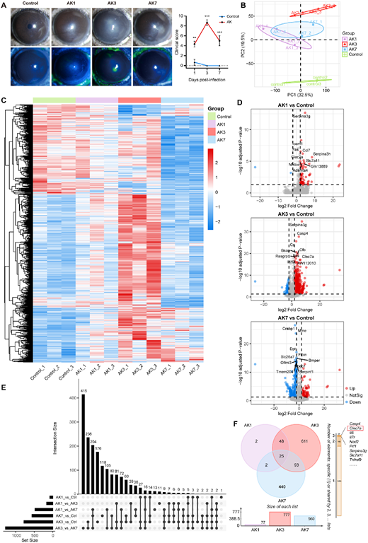 ARVOiovs's tweet photo. Qingfeng Liang et al. from Beijing Tongren Eye Center investigate the dynamic immune response and the role of DECTIN-1 in Acanthamoeba keratitis.
https://t.co/BUEZcEh8k4 https://t.co/VvNYPGxJ1n