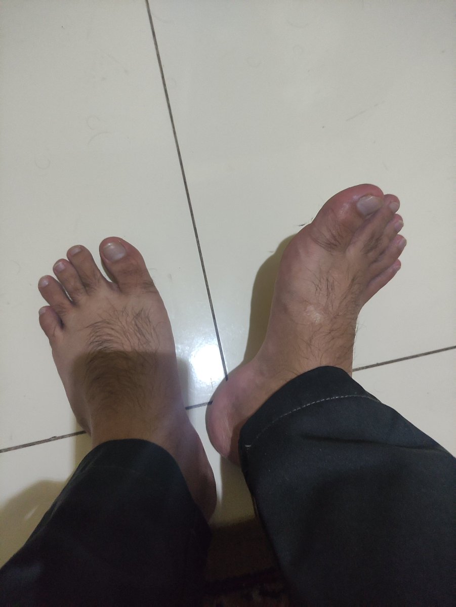 AgroFetiche's tweet photo. Pezão peludo 😏🔥 https://t.co/XRvOyEeBqJ
