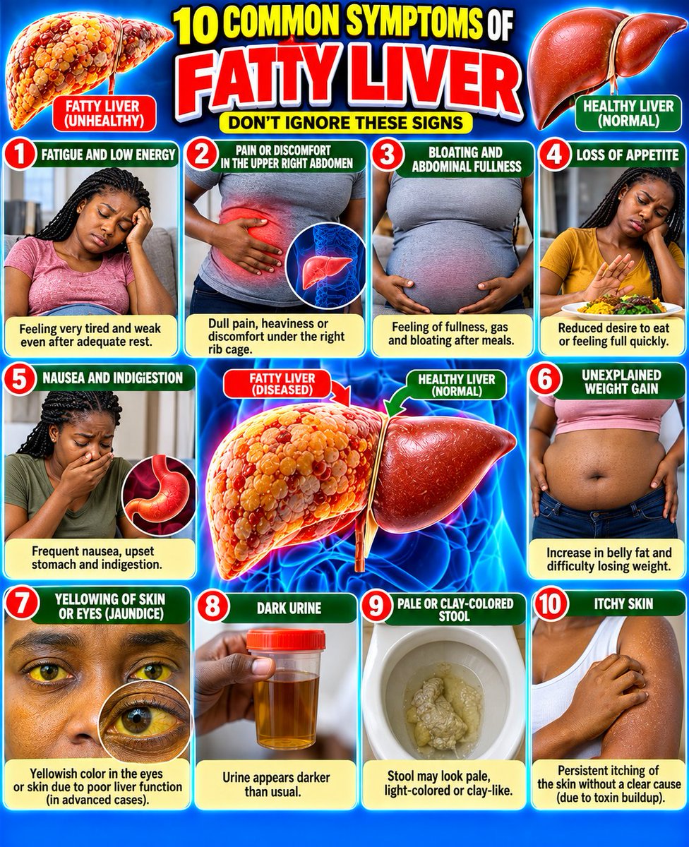 HerbalistHenry_'s tweet photo. 10 Symptoms of FATTY LIVER  and 10 Plants that can help treat and eradicate the condition.. 

Share to someone to enlighten them, don't ignore the signs.. https://t.co/a20ZgQY9ZS