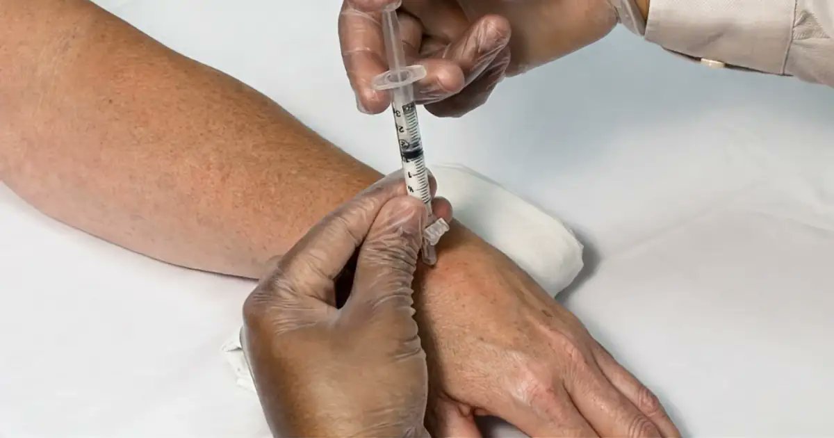 CoryCalendineMD's tweet photo. Can't tell if your wrist pain is arthritis, a tendon, or a nerve? A diagnostic wrist injection can answer that, then calm inflammation for weeks to months. Serious infection: under 1 in 10,000. https://t.co/AIzbNtw244 #WristPain #Orthopedics https://t.co/NrjOPm8CXB