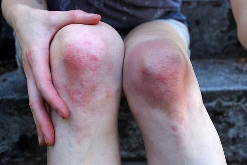perfectcleanse's tweet photo. hit my knee caps with a hammer https://t.co/cKtTJTjppV