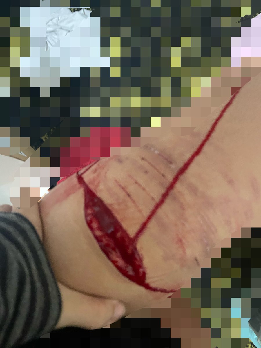 alixrlel's tweet photo. one swipe Kai razors 😵
#beanstwt #owch 

ai sfx not real makeup for Halloween https://t.co/iNsYxO22jC