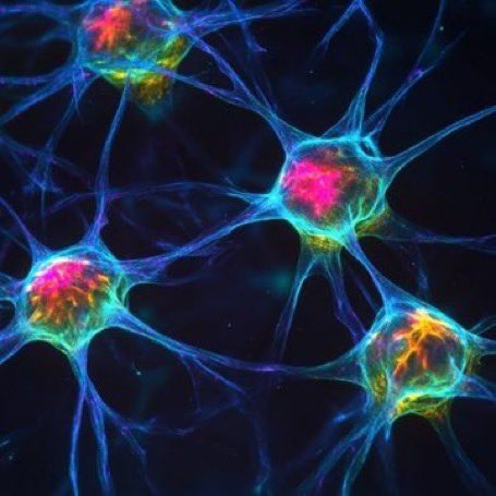 SciNatureNews's tweet photo. JUST IN🚨: Neuroscientists discovered something shocking: your brain doesn't care if your thoughts are true... it just believes whatever you think on repeat https://t.co/jKjRAqjuzR