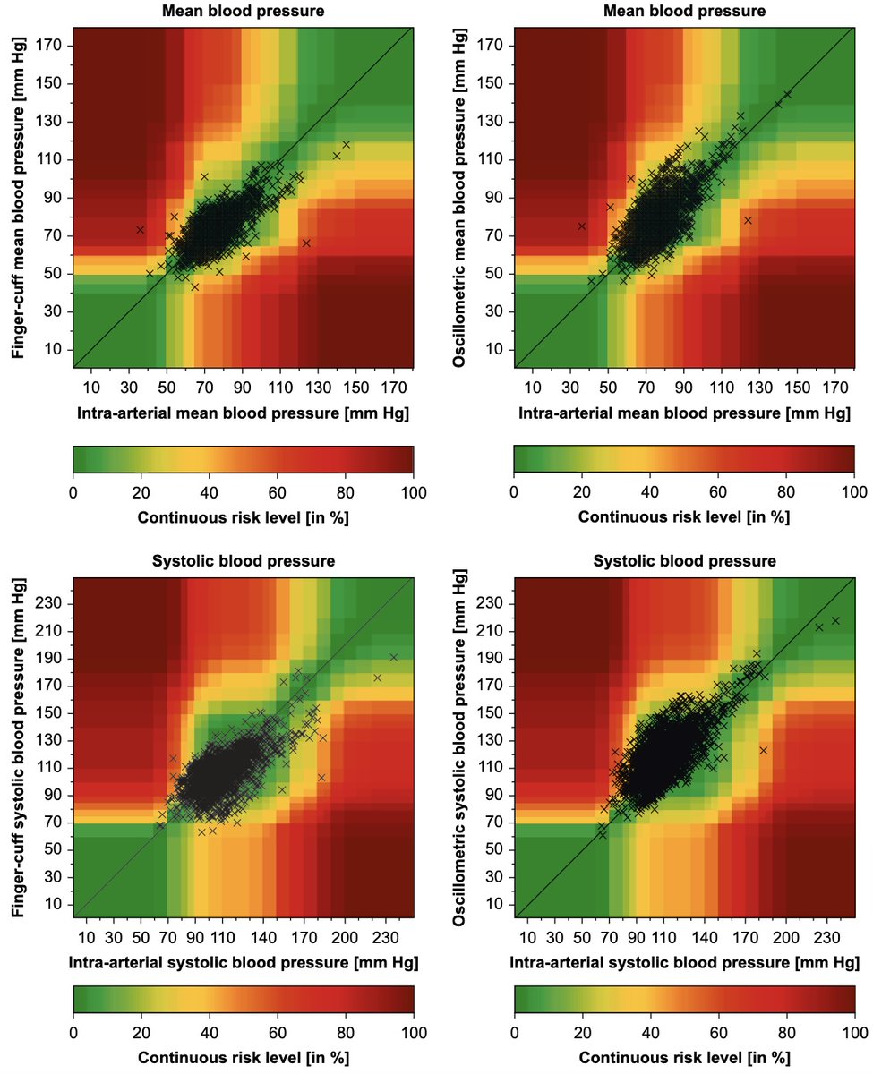BJAJournals's tweet photo. #Finger cuff and #oscillometric BP measurements are as reliable compared to #arterial measurements in #cardiac patients, according to Bergholz et al. Finger cuffs could potentially replace arm/leg cuffs.
https://t.co/SrmedfWdkX https://t.co/7fYKSkw6m9