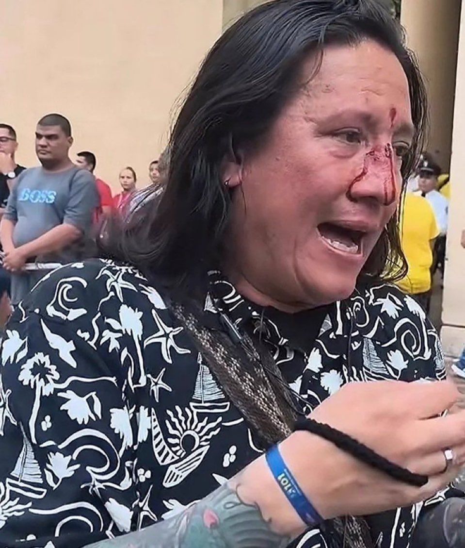 mamaR3ntas's tweet photo. El esmad me golpeó! 
Ayuden a difundir por favor 😭 https://t.co/YVfJRNxIqo