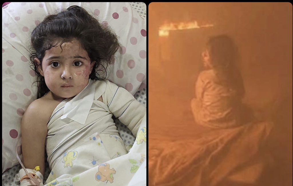 AbujomaaGaza's tweet photo. Israeli occupation military burned Mariam’s mother in front of her eyes this night in Gaza https://t.co/lQ0SU2pc4B