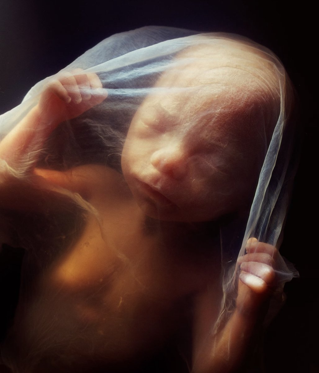 KristanHawkins's tweet photo. Not tissue. 

Not a parasite. 

Not a clump of cells.     

A baby. https://t.co/mfnBZzdoaS