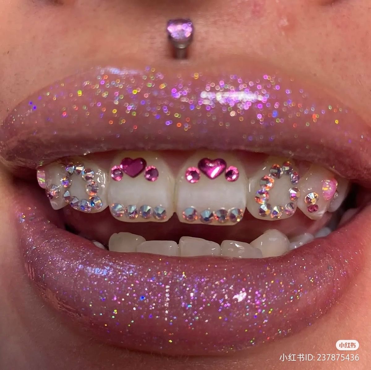 virtualh3arts's tweet photo. Tooth gems and grillz ༺💓༻ https://t.co/Pr74qt3mtj