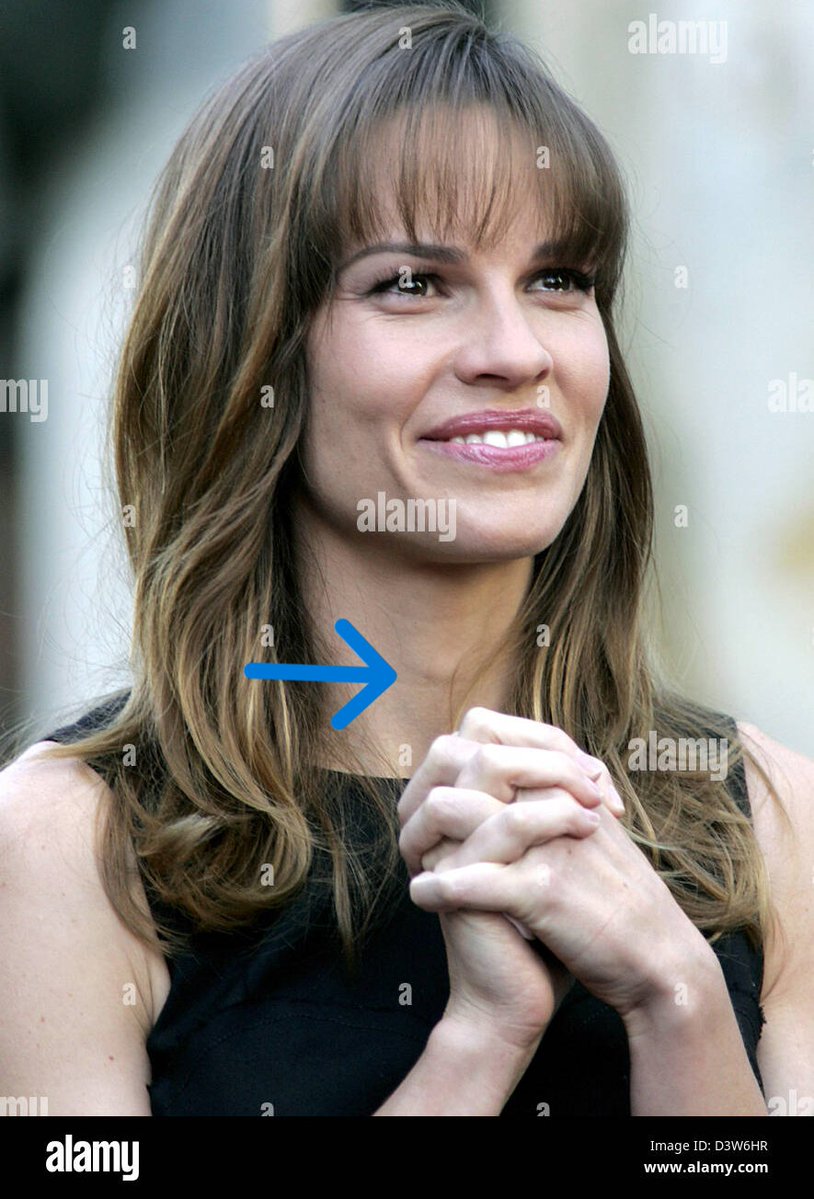 egg335374's tweet photo. 52-year-old Hilary Swank announced a second fake pregnancy today.

Hilary claims to have given birth to twins in 2023 at age 48, with the only body weight gain appearing to be  a silicone moonbump (second pic).

The public just can't get enough of Hollywood men with Adam's apples, adonis belts, and male gaits lying about being pregnant.

And the older the troon the more they love it...falling for the purposely set trap of believing bio females have no problem bearing children later in life.