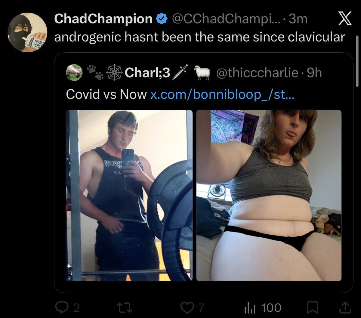 indygroyper's tweet photo. Still thinking about Clavicular because he wants to think about a man that isn’t the drug dealer that made Chumpion’s girl his favorite Barbie doll… https://t.co/vEDnqtpVP2