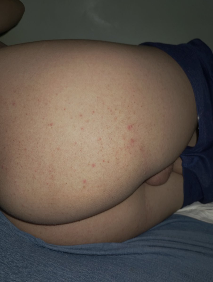 secret_nhoa's tweet photo. Imagine vc metendo assim de ladinho nessa raba carnuda
Dm(vou mandar vídeo do cuzinho carnudo)

#PINTOSAWARDSㅤㅤ 
#PINTOAWARDSㅤㅤ 
#TROCONUDSㅤ 
#pintosawardgayㅤ 
#pintoawardsㅤㅤㅤ 
#brotheragemheteroㅤㅤㅤ 
#novinhodopirocão https://t.co/udg7cWEYT8