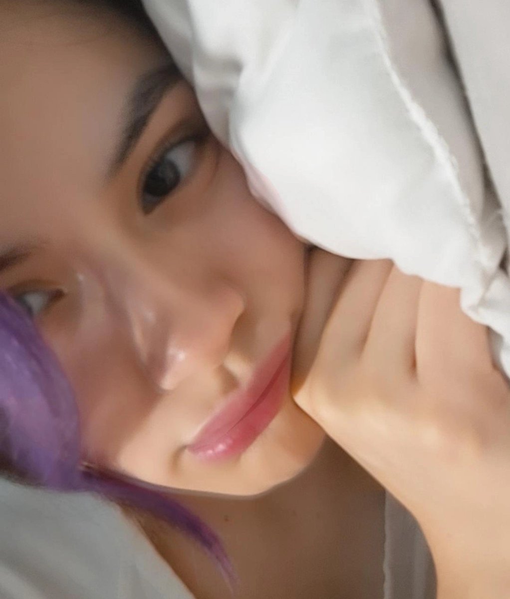 NaocchiUwU's tweet photo. Papus, necesito su ayuda ❤️‍🩹

Mañana me pondrán otro suero de hierro y también necesito comprar medicamentos para tratar mi anemia Todo esto representa un gasto bastante grande y necesito un poquito de ayuda para poder costearlo 🫂 https://t.co/jMdVodgKnY
