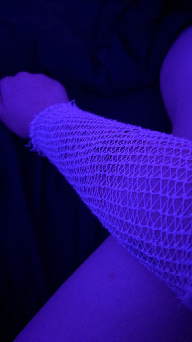 vinthevoidcx's tweet photo. They gave me this thing cuz I keep scratching and ripping out stitches in my sleep #whoosh https://t.co/EI2wD5Sxth