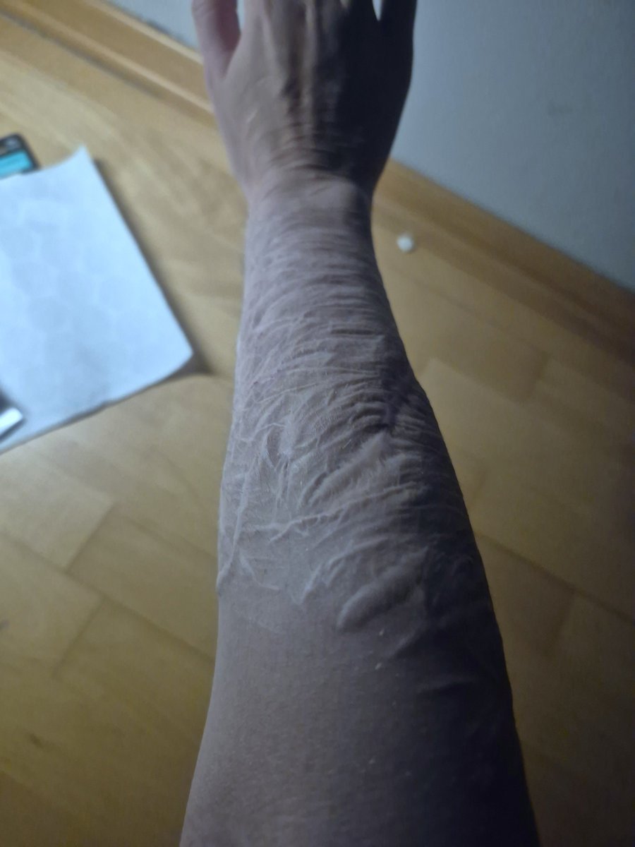 Isob8888's tweet photo. Scars
#cutapo https://t.co/FINlwCFACN