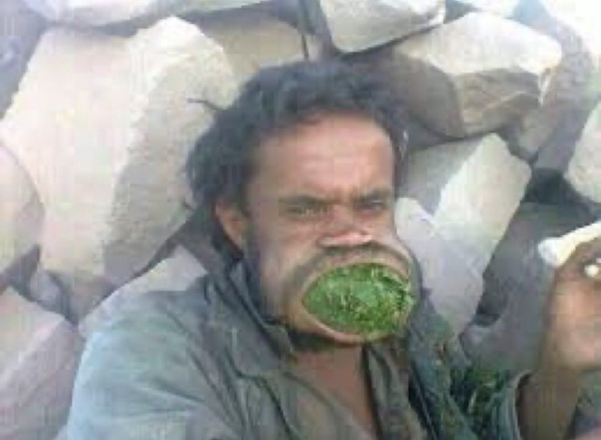 deema8u's tweet photo. @kahlan_911 هههههههههههه كيف ادخل في نقاش مع هذا 👇🏻جاهل وشحاذ ومدعوس ومعدم !! تخيلو لدرجة مايعرف شي اسمه مدرسة  !!!؟؟ يحسب الناس للحين تدرس فالمساجد😂😂 https://t.co/ozdjJTYQoD