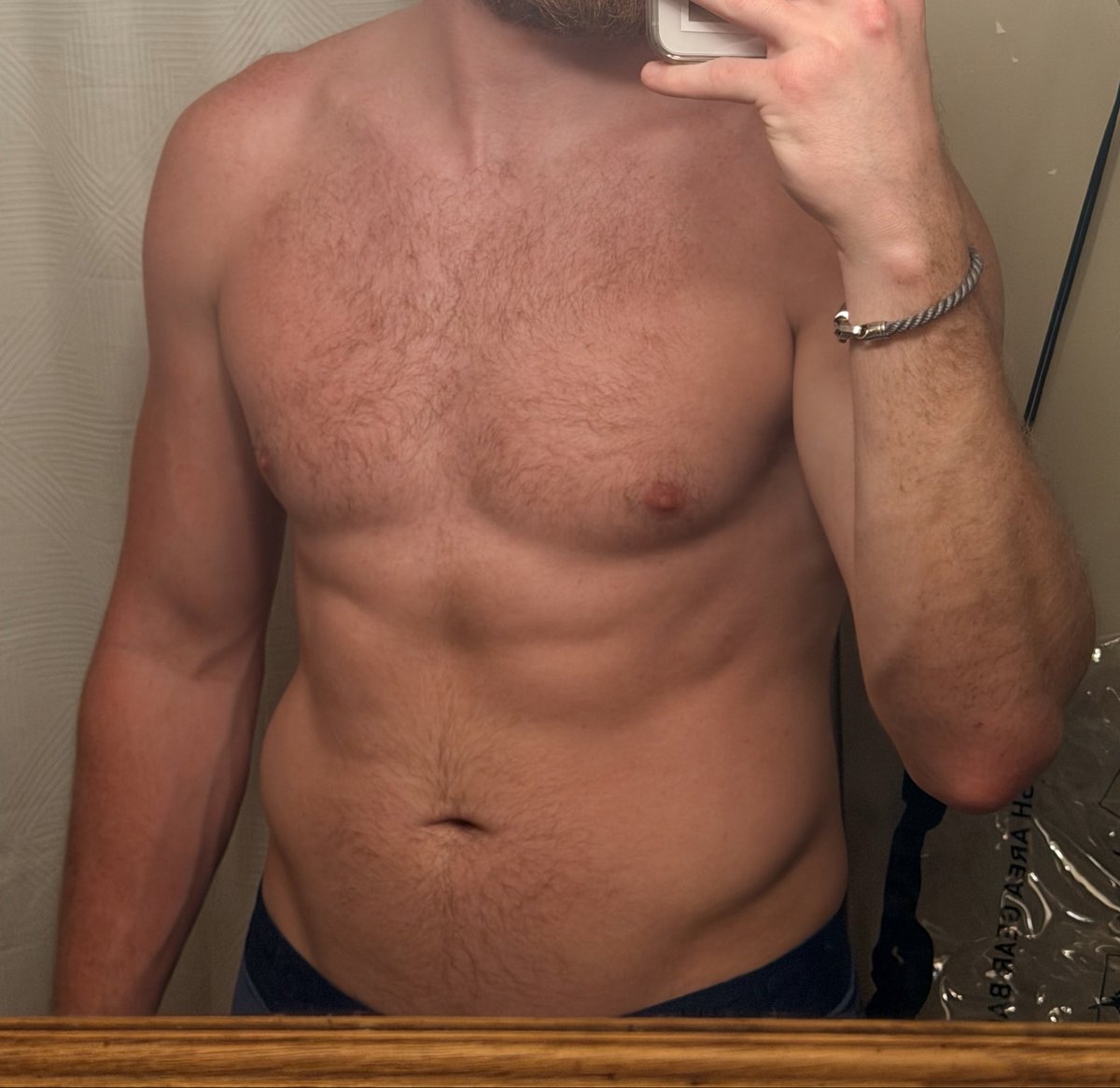 Gregstocome's tweet photo. Need a massage https://t.co/XU7C2D6kEO
