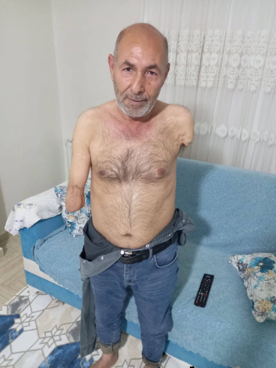 SuphesizG's tweet photo. Her iki kolu olmayan engelli vatandaşın evde bakım ücreti raporunda tam bağımlı ibaresi olmadığı için kesilmiş. Bu vatandaş Batman/Gercüş ilçesi Kayalar köyünde yaşıyor. Kimse bu konu ile ilgilenmiyor.
@MahinurOzdemir https://t.co/S924FQws8F