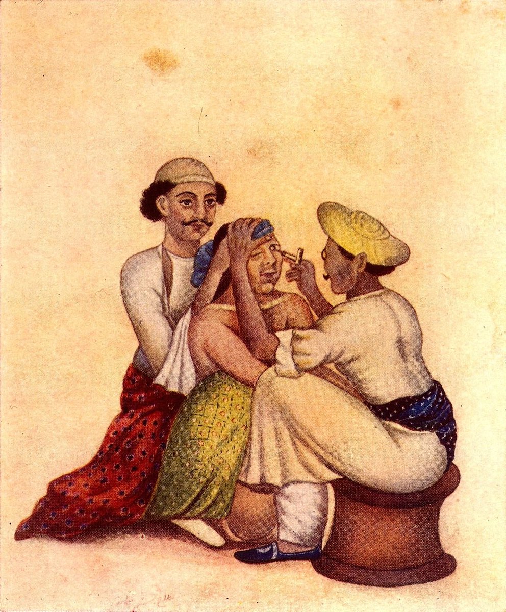 Fintech03's tweet photo. An Indian eye-surgery book vanished from China. Korea kept part of it.

The operation was cataract couching: a needle goes in beside the white of the eye and pushes the clouded lens out of the way. The Sushruta Samhita describes the Indian procedure. 

By the Tang dynasty it was in Chinese medicine, taught under the name of one book, the Longshu pusa yanlun, "Bodhisattva Nagarjuna's eye treatise". 

In 752 Wang Tao's Waitai miyao already quotes an older Indian treatise on the eye.

Then the trail breaks. The original Longshu book was not handed down in China. A large part of it was copied into Korea's great medical compendium Uibang yuchwi, compiled under King Sejong in 1445. 

It has 8 sections and 30 eye diseases. It names heat and wind as main causes. It says the cataract forms when poison and heat gather in the brain and the eye's "oil" runs down over the pupil.

And it gives the golden-needle method step by step, to be done only when the film has hardened "like white jade".

Korean scholars Kim and Kang call it a record of Indian medical ideas already lost in China.

An operation travelled from India to China. The Chinese copies of the book were lost. A Korean encyclopedia kept the text. 🙏🙏

Sources: Wang Tao, Waitai miyao (752); Yi fang lei ju vol. 64 (Joseon); Kim & Kang, Korean J. Med. Hist. 22(1), 2013; Deshpande, Bull. SOAS (1999)

Photo 1: Cataract couching in India (painting, undated). Wellcome Library, London, CC BY 4.0

Photo 2: Uibang yuchwi, volume 201 cover (Joseon, 1477 per Commons). Public domain, via Wikimedia Commons