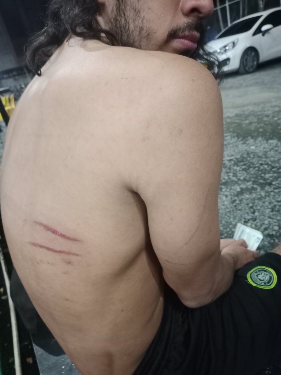 camilo040494's tweet photo. Hace rato no arañaban así en un partido 
Con razón sentía ardor en esa zona https://t.co/OLytiNwSDh