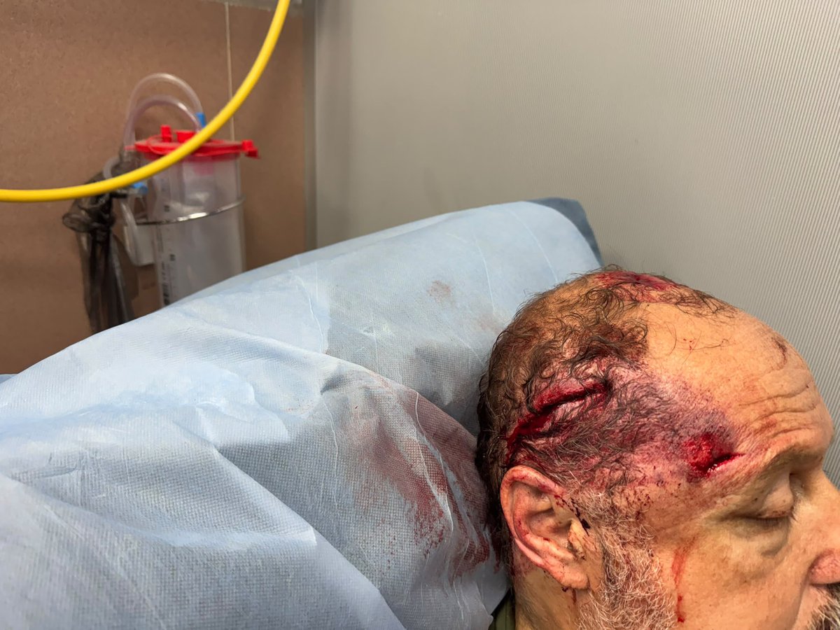 infinite_jaz's tweet photo. An American citizen, Haytham Taysir, was just severely beaten by settlers in his olive groves in Burqa, Ramallah. @GovMikeHuckabee how’s that crackdown on settler terrorists going? https://t.co/VTvqzXbLwt