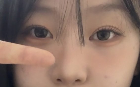bukee66's tweet photo. 그동안 받았던 수술/시술 정리 🥵🥵🥵

입술필러/옆볼필러/보톡스/코수술/쌍수 등

추가로 궁금한점은 스핀남겨주세요이

<코수술>
저는 코가 엄청엄청엄청 낮고 작고 짧은
복코였는데요 진짜 잘됐음 

콧대는 실리콘 
코끝은 귀연골 빼서 만들었더요🫰💕

전부 애프터>비포 입니다 두장씩!! https://t.co/9KLxho1nnL