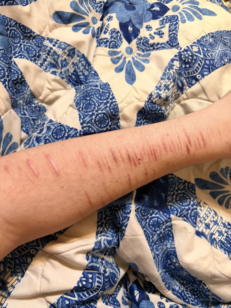 FUCKMYLIFE2882's tweet photo. My fake SFX battle scars https://t.co/dF7SKQ34mr