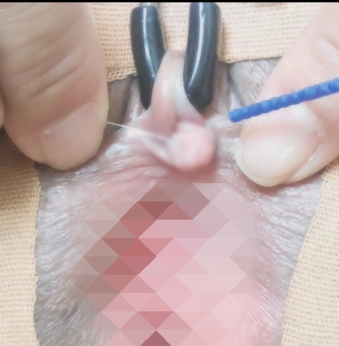 p_hreichan5's tweet photo. #clitoris #clitoris stimulation #clitoris binding #clitoris suction #clitoris torture #clitoris electric current #clitoris only #clitoris bdsm #clitoris bondage #clitoris acupuncture #clitoris needle #clit clothespins #Hard clitoral torture https://t.co/GwT4PFO1g8