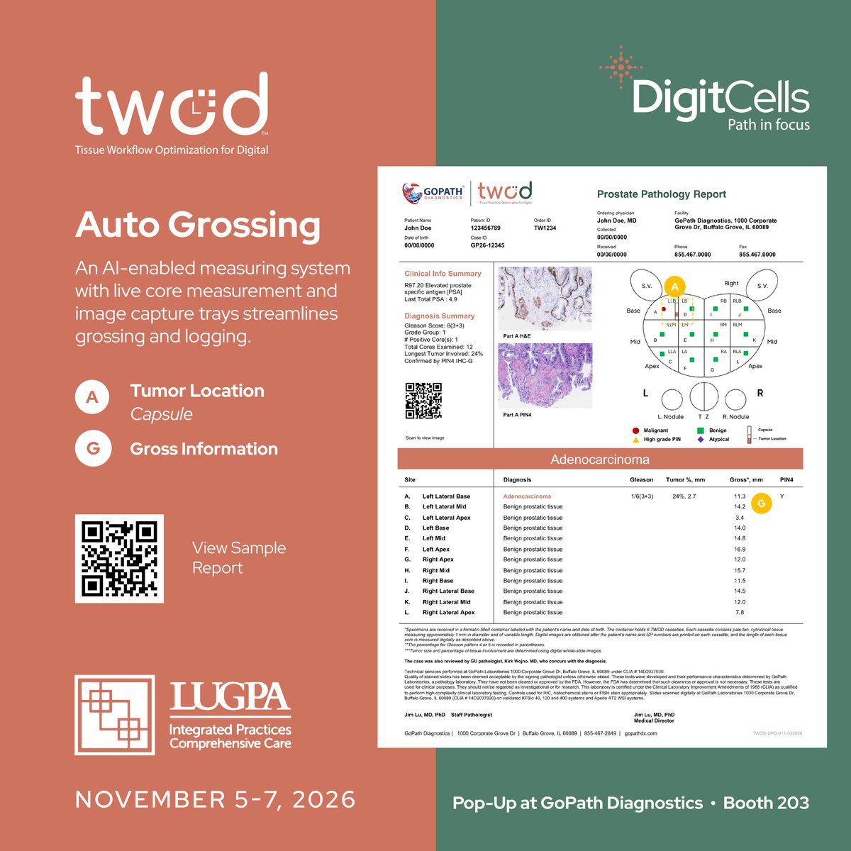 DigitCells's tweet photo. Behind every biopsy result is a workflow, &amp; the details of that workflow matter. We will be featured inside the @GoPathLabs booth at #LUGPA2026. Stop by to see it in action &amp; learn what a more connected pathology workflow could look like.

Learn more: https://t.co/nSfeh7lDbL https://t.co/dJH9iuxbPP
