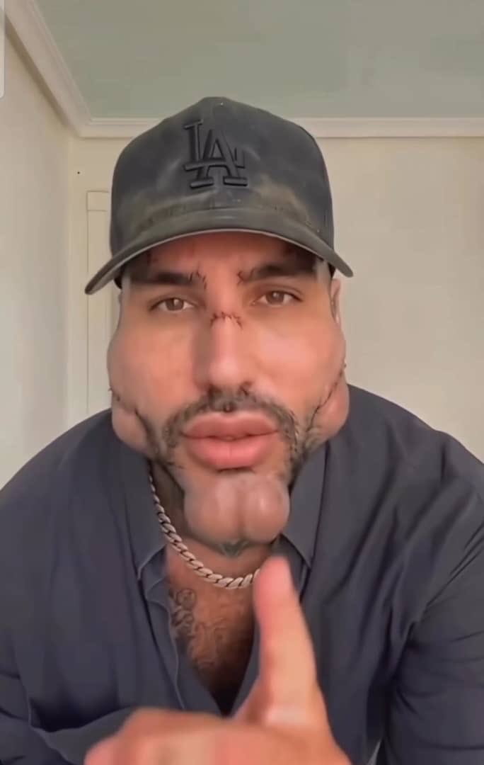 Heyseeto's tweet photo. I had no idea men now get face jobs done. There's only one thing that comes to mind when you see this tho😂💔 https://t.co/BEas7NmPfe