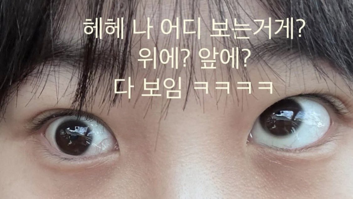 silulu___'s tweet photo. 눈밑지 부작용임. 시술이던 수술이던 성형은 신중하게해야함 https://t.co/28K8lPWnv7