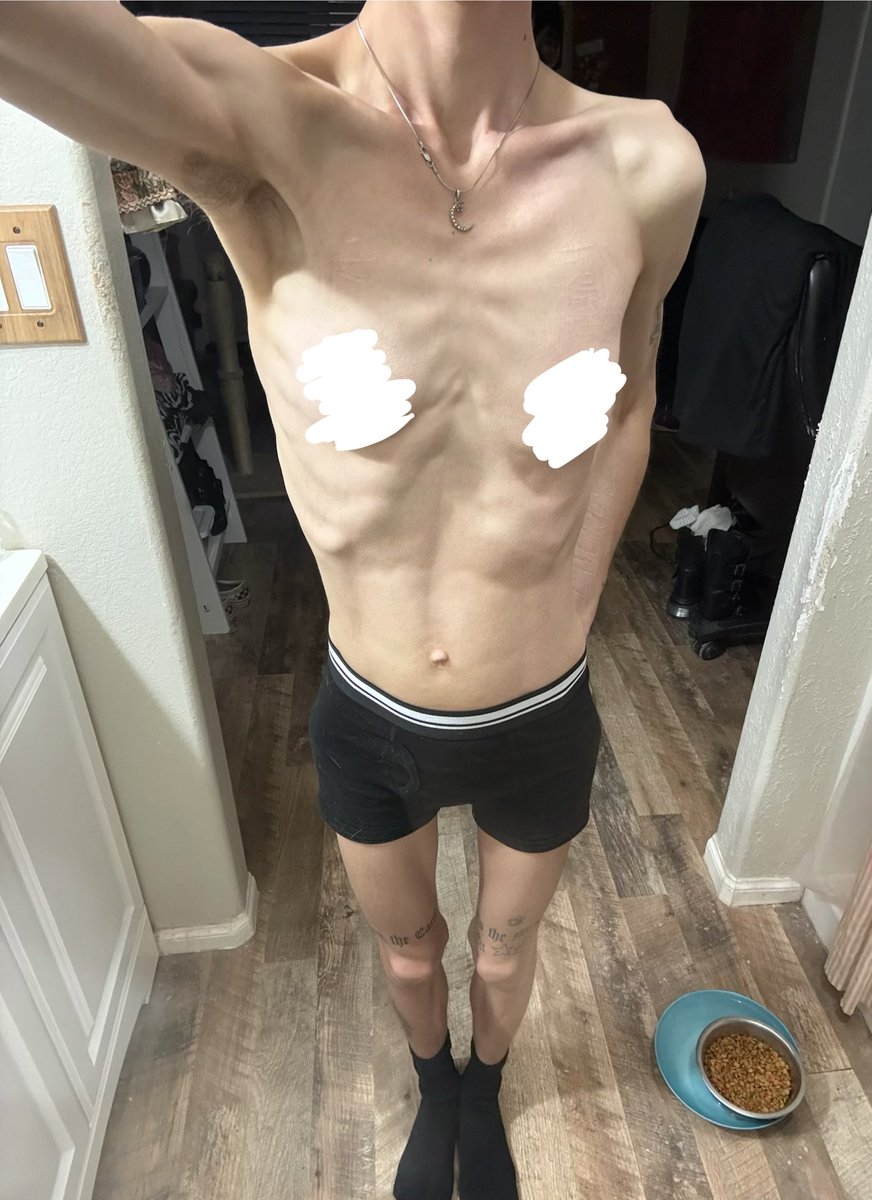 BonesNBobo's tweet photo. Morning bc: not using the toilet LOL woke up “maintaining” which is gud/ok!! It’s so chilly 2day making sure to layer up 4pump patch +coffee shop!! ₍՞◌′ᵕ‵ू) #edrtwt #bodycheck #ricecaketwt https://t.co/fC8e3ohhIe