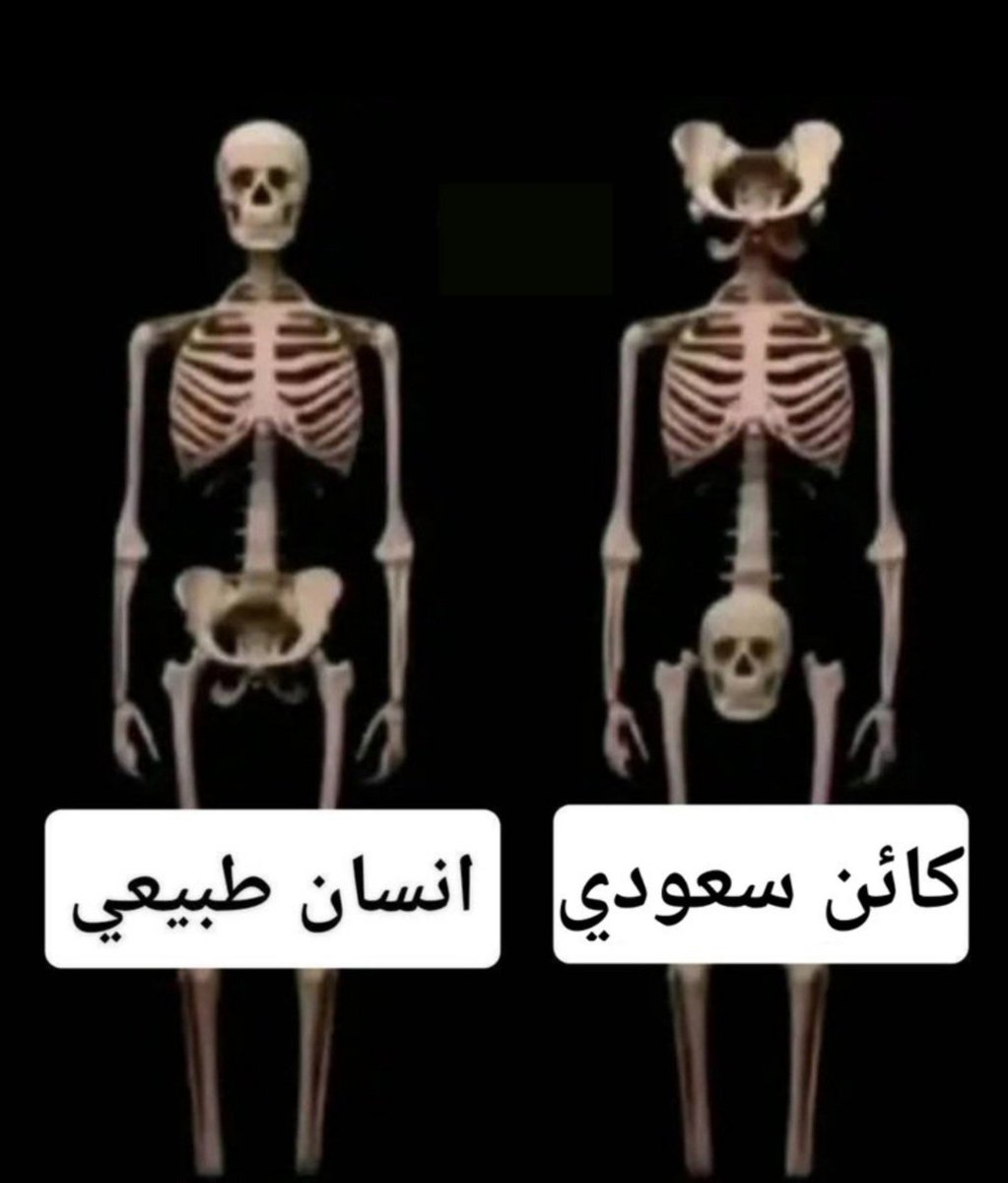 mha_abbas's tweet photo. @HRH010 الكائن التعوسي https://t.co/3jALOembHD