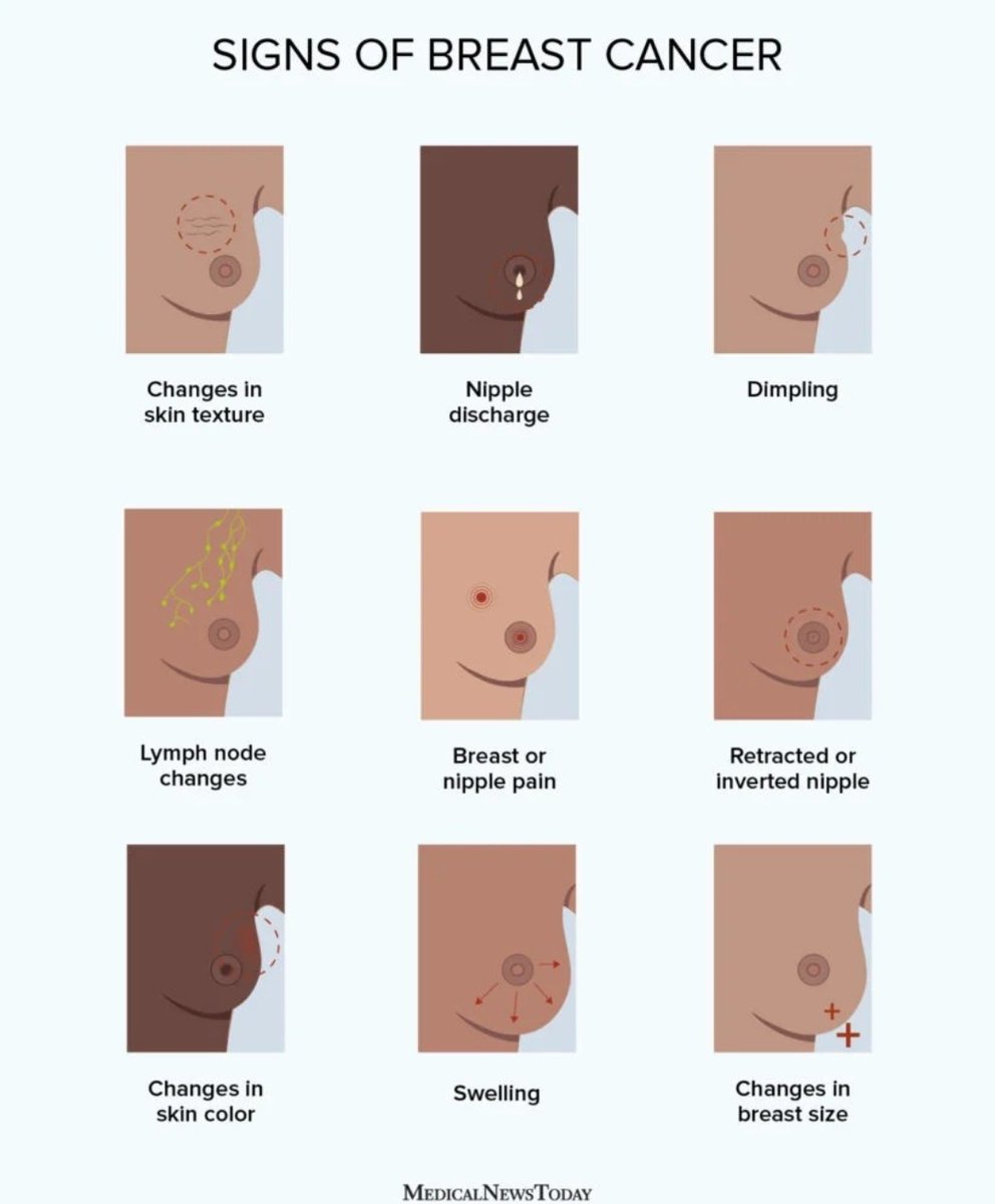 Venus_AI_'s tweet photo. REMEMBER TO CHECK YOUR CHEST!!!! PLEASE!! IF YOU ARE IN THE UK DO NOT BE AFRAID TO GO TO YOUR GP THEY WILL GIVE YOU SCANS/ULTRASOUNDS. DO NOT PUT IT OFF!!!!!! https://t.co/yzqOB4LAIv