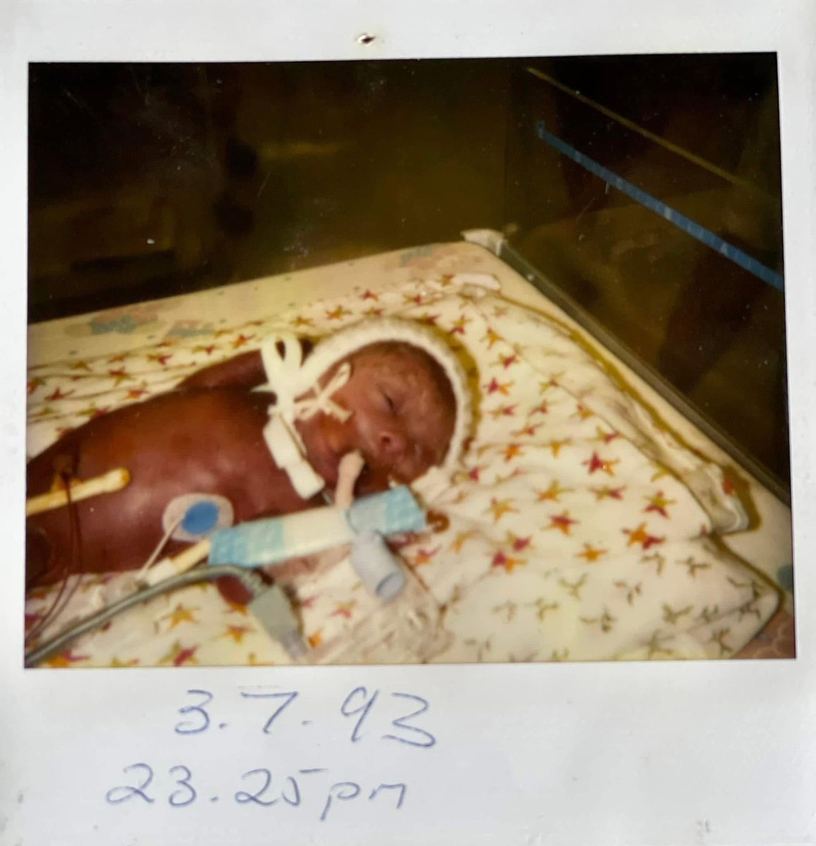 Pinkypielovesu's tweet photo. Wave of light for my beautiful Liam 🩷🪽👼
3.7.1993 you will never be forgotten and mummy loves you so very much 🪽🩷
Light a candle and continue the wave of light, for all those babies who didn’t make it…… you will never be forgotten 💙🤍 https://t.co/mzJgFNsvrT
