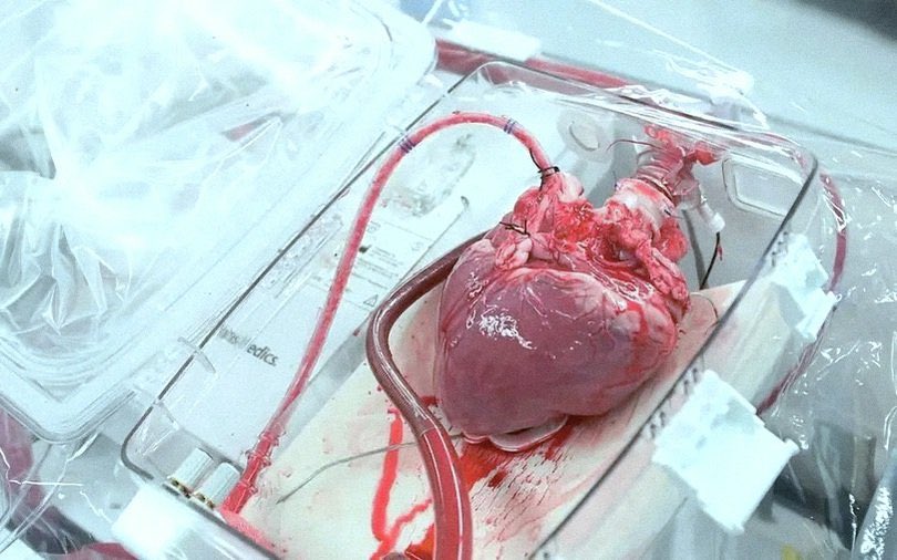 nursevomit's tweet photo. a nurses love goes straight to the heart ʚ♡⃛ɞ https://t.co/J3psCERAhG