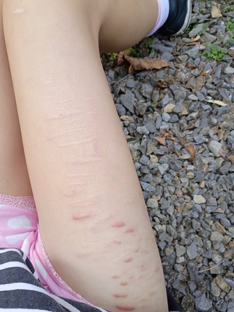 Ggfdddhx's tweet photo. Guys I'm scarspo right 😁 https://t.co/p6YqOaJSXs